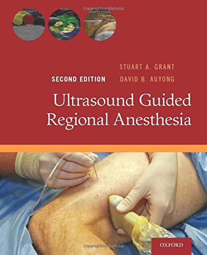 Algopix Similar Product 7 - Ultrasound Guided Regional Anesthesia