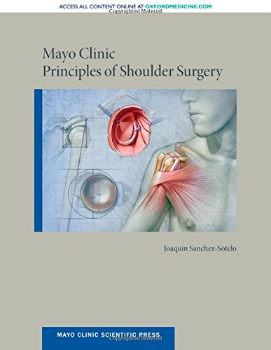 Algopix Similar Product 1 - Mayo Clinic Principles of Shoulder