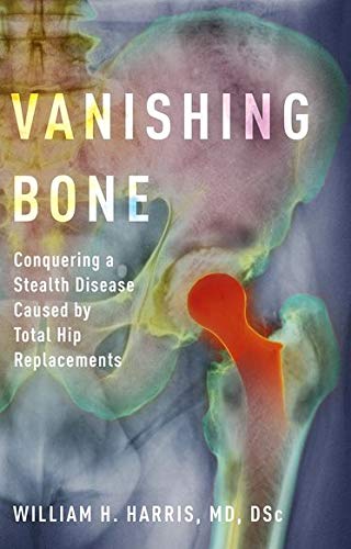 Algopix Similar Product 17 - Vanishing Bone Conquering a Stealth