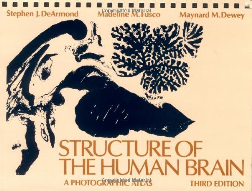 Algopix Similar Product 9 - Structure of the Human Brain A