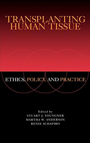Algopix Similar Product 6 - Transplanting Human Tissue Ethics