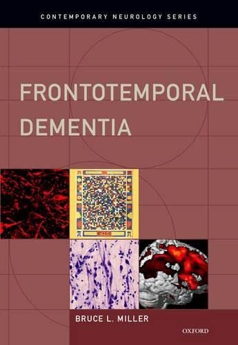 Algopix Similar Product 6 - Frontotemporal Dementia Contemporary