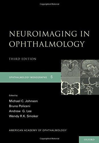 Algopix Similar Product 15 - Neuroimaging in Ophthalmology American