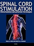 Algopix Similar Product 19 - Spinal Cord Stimulation Percutaneous