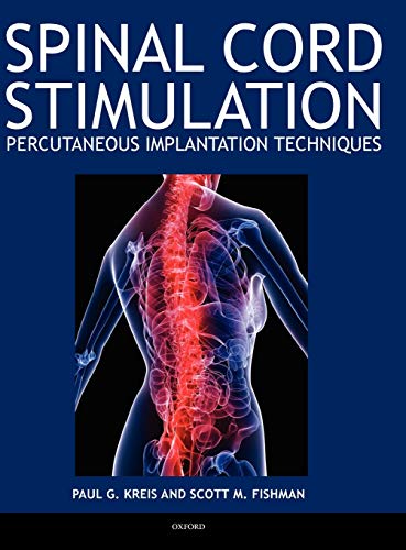 Algopix Similar Product 13 - Spinal Cord Stimulation Percutaneous
