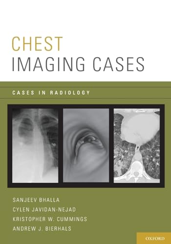 Algopix Similar Product 17 - Chest Imaging Cases (Cases in Radiology)