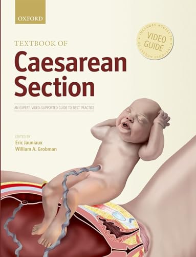 Algopix Similar Product 7 - Textbook of Caesarean Section