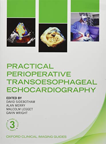 Algopix Similar Product 19 - Practical Perioperative