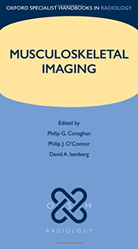 Algopix Similar Product 3 - Musculoskeletal Imaging Oxford