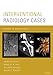 Algopix Similar Product 6 - Interventional Radiology Cases Cases