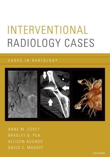 Algopix Similar Product 1 - Interventional Radiology Cases Cases