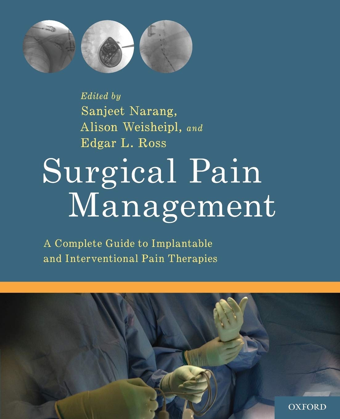 Algopix Similar Product 3 - Surgical Pain Management A Complete