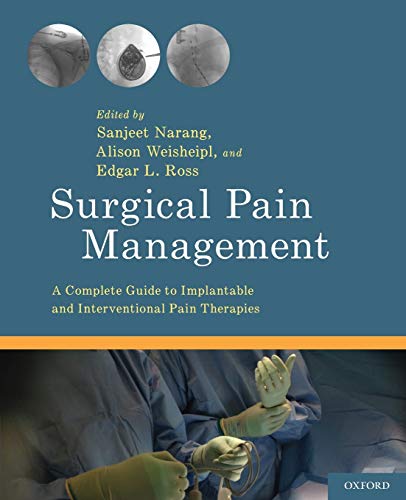Algopix Similar Product 10 - Surgical Pain Management A Complete