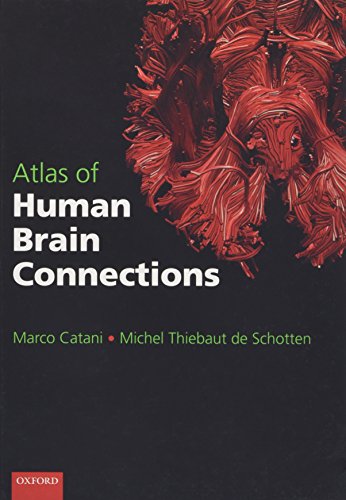 Algopix Similar Product 7 - Atlas of Human Brain Connections