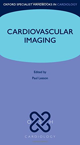 Algopix Similar Product 9 - Cardiovascular Imaging Oxford