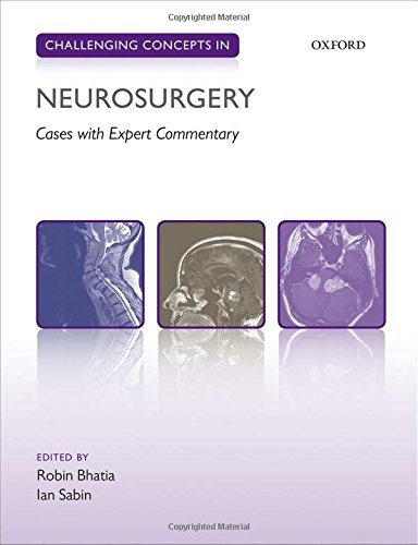 Algopix Similar Product 12 - Challenging Concepts in Neurosurgery