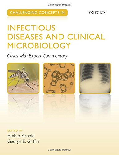 Algopix Similar Product 20 - Challenging Concepts in Infectious
