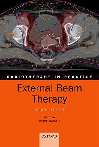 Algopix Similar Product 9 - External Beam Therapy Radiotherapy in