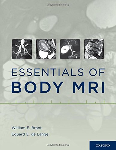 Algopix Similar Product 19 - Essentials of Body MRI
