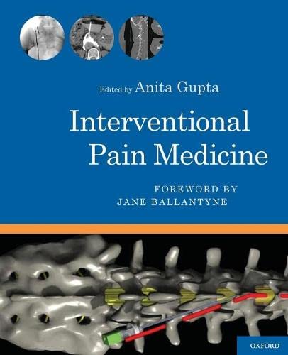 Algopix Similar Product 1 - Interventional Pain Medicine