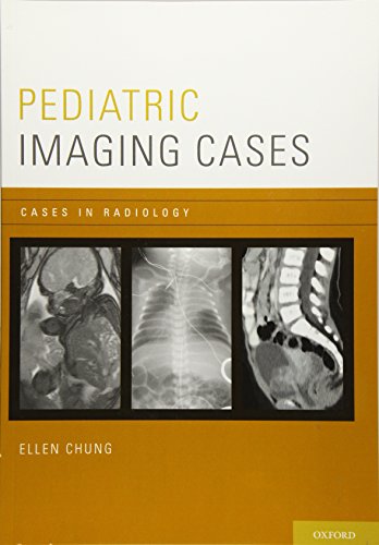Algopix Similar Product 13 - Pediatric Imaging Cases Cases in