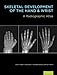Algopix Similar Product 20 - Skeletal Development of the Hand and