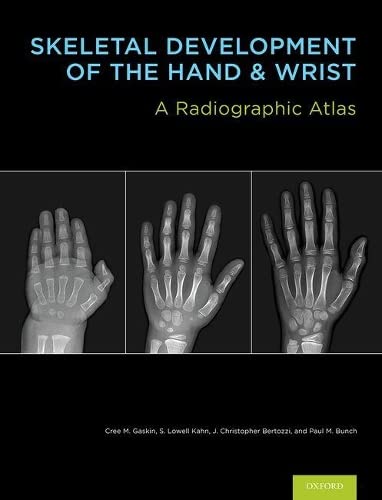 Algopix Similar Product 11 - Skeletal Development of the Hand and