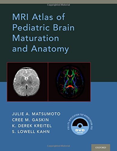 Algopix Similar Product 10 - MRI Atlas of Pediatric Brain Maturation
