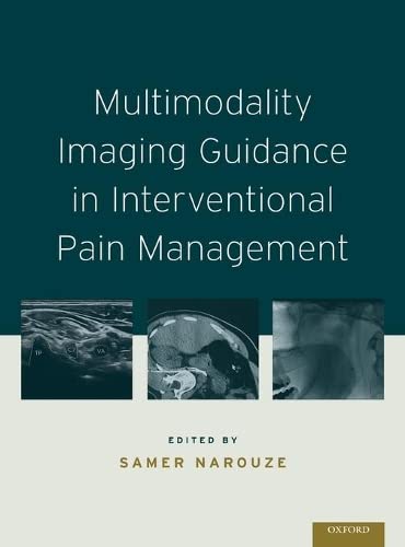 Algopix Similar Product 8 - Multimodality Imaging Guidance in