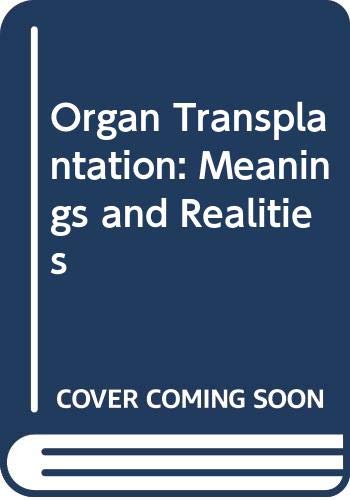 Algopix Similar Product 16 - Organ Transplantation Meanings and