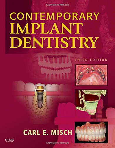 Algopix Similar Product 11 - Contemporary Implant Dentistry