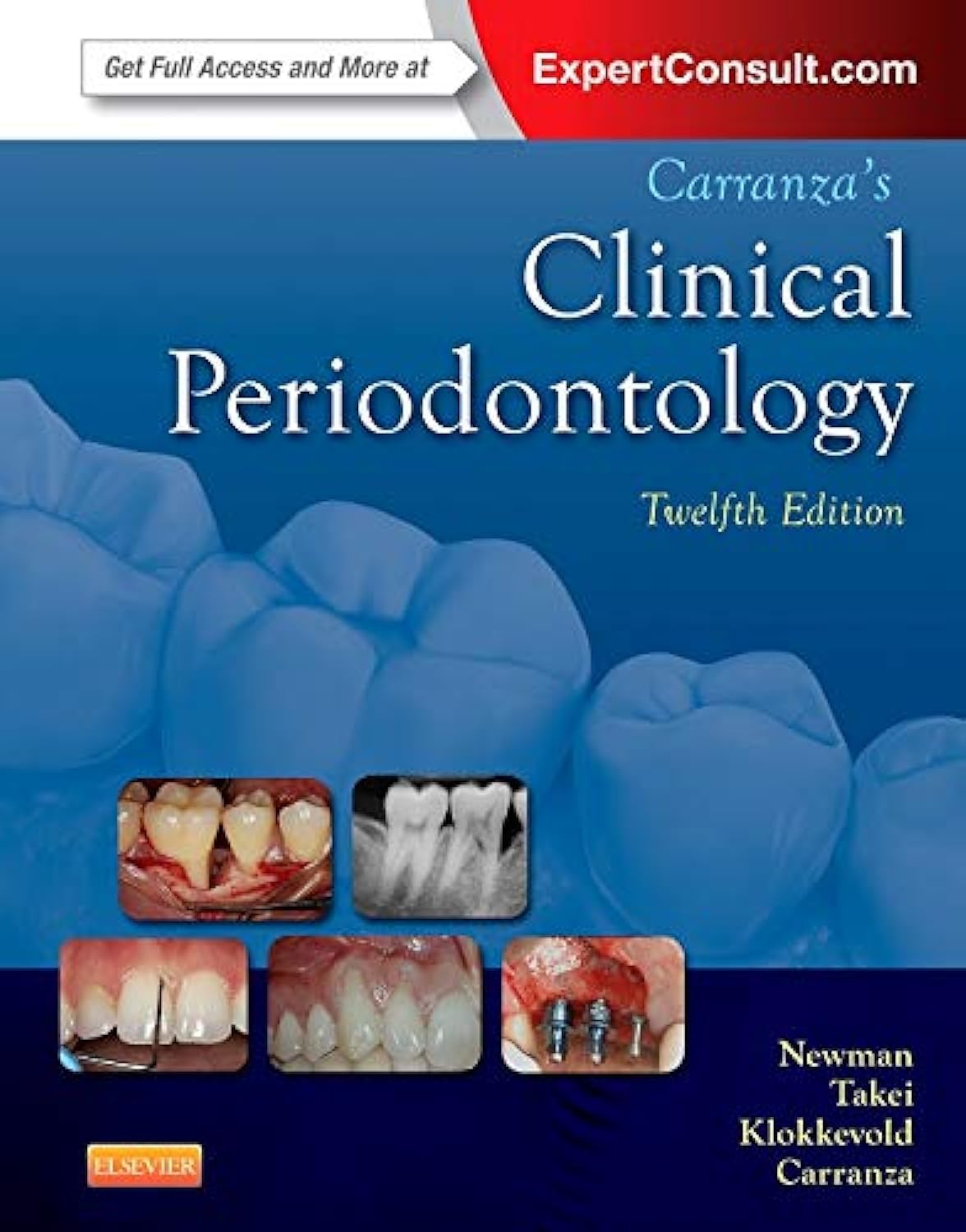 Algopix Similar Product 19 - Carranzas Clinical Periodontology