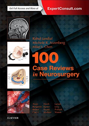 Algopix Similar Product 6 - 100 Case Reviews in Neurosurgery