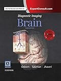 Algopix Similar Product 1 - Diagnostic Imaging: Brain