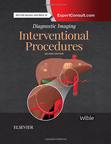 Algopix Similar Product 2 - Diagnostic Imaging Interventional
