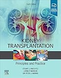 Algopix Similar Product 11 - Kidney Transplantation  Principles and
