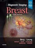 Algopix Similar Product 13 - Diagnostic Imaging: Breast