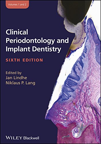 Algopix Similar Product 2 - Clinical Periodontology and Implant