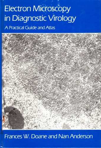 Algopix Similar Product 9 - Electron Microscopy in Diagnostic