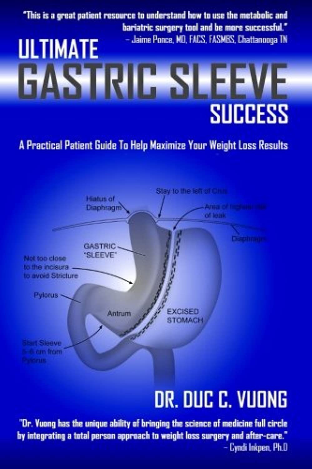 Algopix Similar Product 5 - Ultimate Gastric Sleeve Success A
