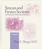 Algopix Similar Product 13 - Smears and Frozen Sections in Surgical
