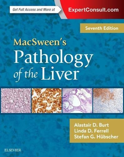 Algopix Similar Product 8 - MacSween's Pathology of the Liver
