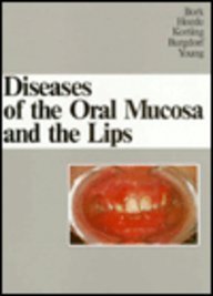 Algopix Similar Product 1 - Diseases of the Oral Mucosa and the Lips