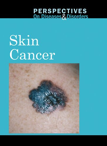 Algopix Similar Product 4 - Skin Cancer Perspectives on Diseases