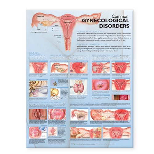Algopix Similar Product 13 - Common Gynecological Disorders