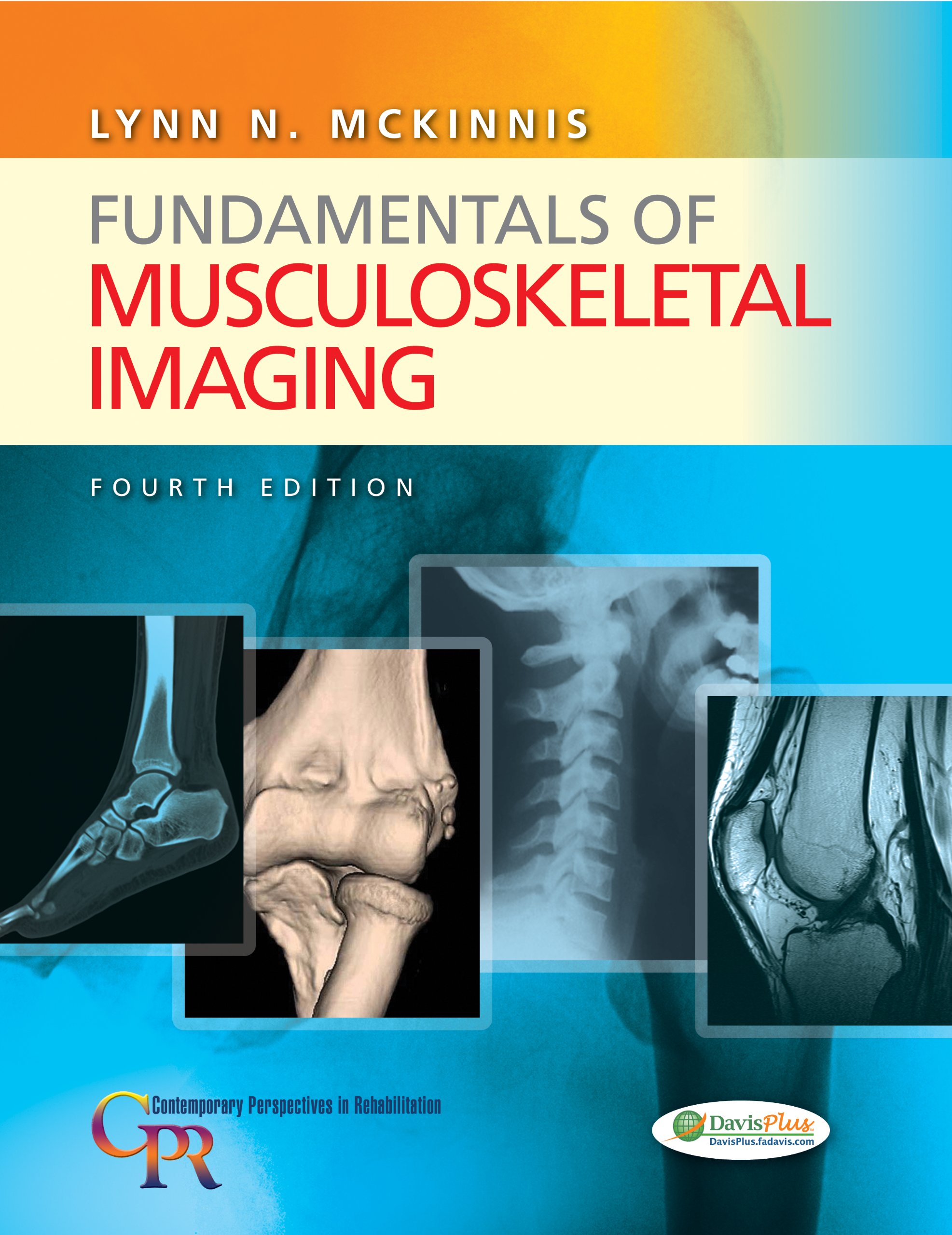 Algopix Similar Product 1 - Fundamentals of Musculoskeletal Imaging