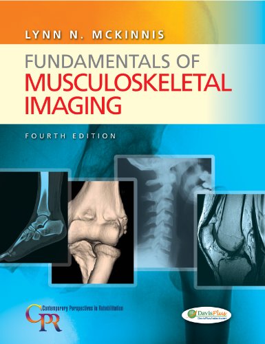 Algopix Similar Product 8 - Fundamentals of Musculoskeletal Imaging