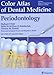 Algopix Similar Product 5 - Color Atlas of Dental Medicine 1