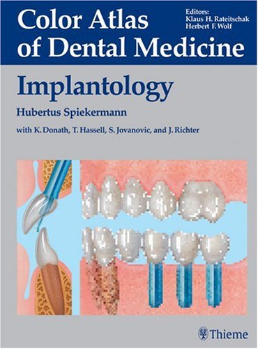 Algopix Similar Product 9 - Implantology