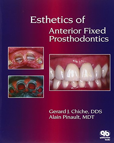 Algopix Similar Product 15 - Esthetics of Anterior Fixed